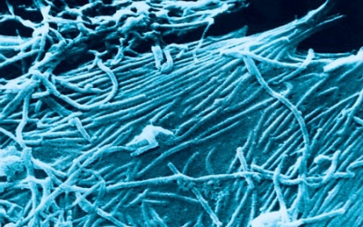 Vaccine dạng xịt mũi giúp phòng ngừa virus Ebola